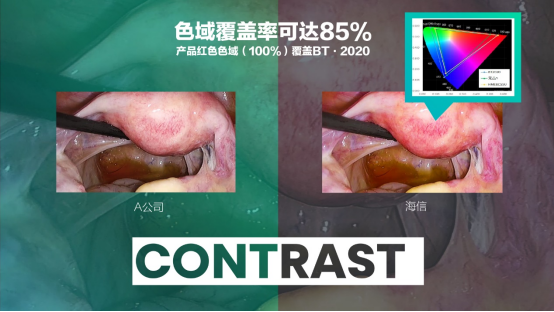 07 海信發(fā)布全球首臺55吋Mini-LED醫(yī)用內(nèi)窺顯示器631.png